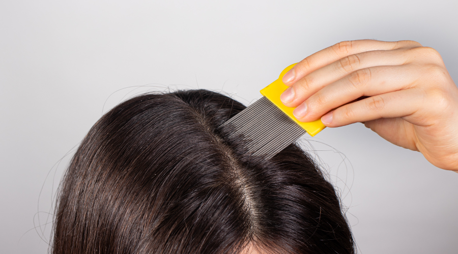 Itchy Scalp Treatments