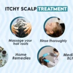 How Itchy Scalp Treatments Soothe Persistent Irritation