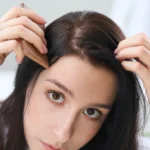 Which Itchy Scalp Treatments Work For Dandruff