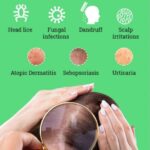 Why Itchy Scalp Treatments Are Often Overlooked