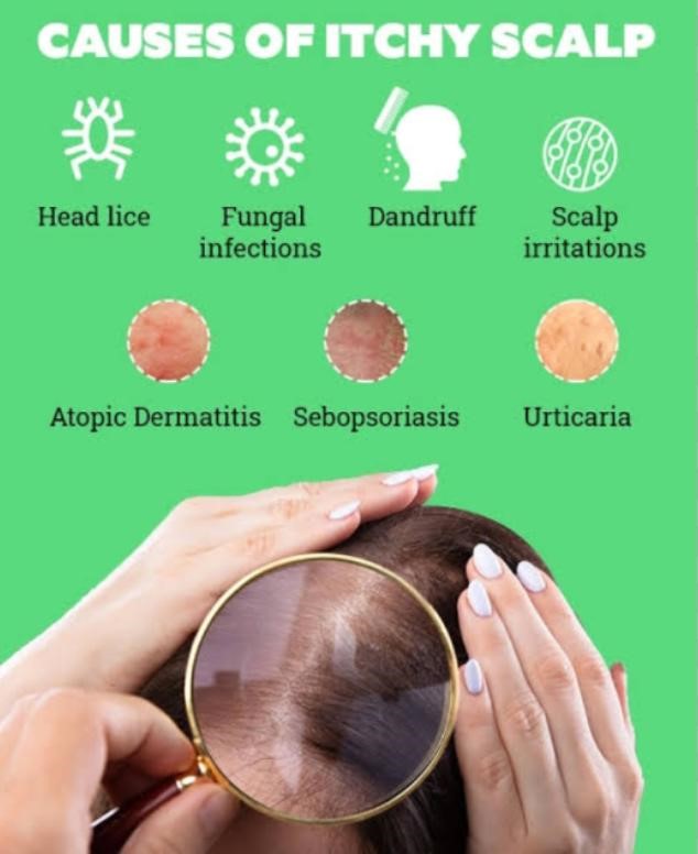 Why Itchy Scalp Treatments Are Often Overlooked