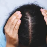 Do Itchy Scalp Treatments Improve Hair Health