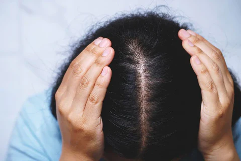 Do Itchy Scalp Treatments Improve Hair Health