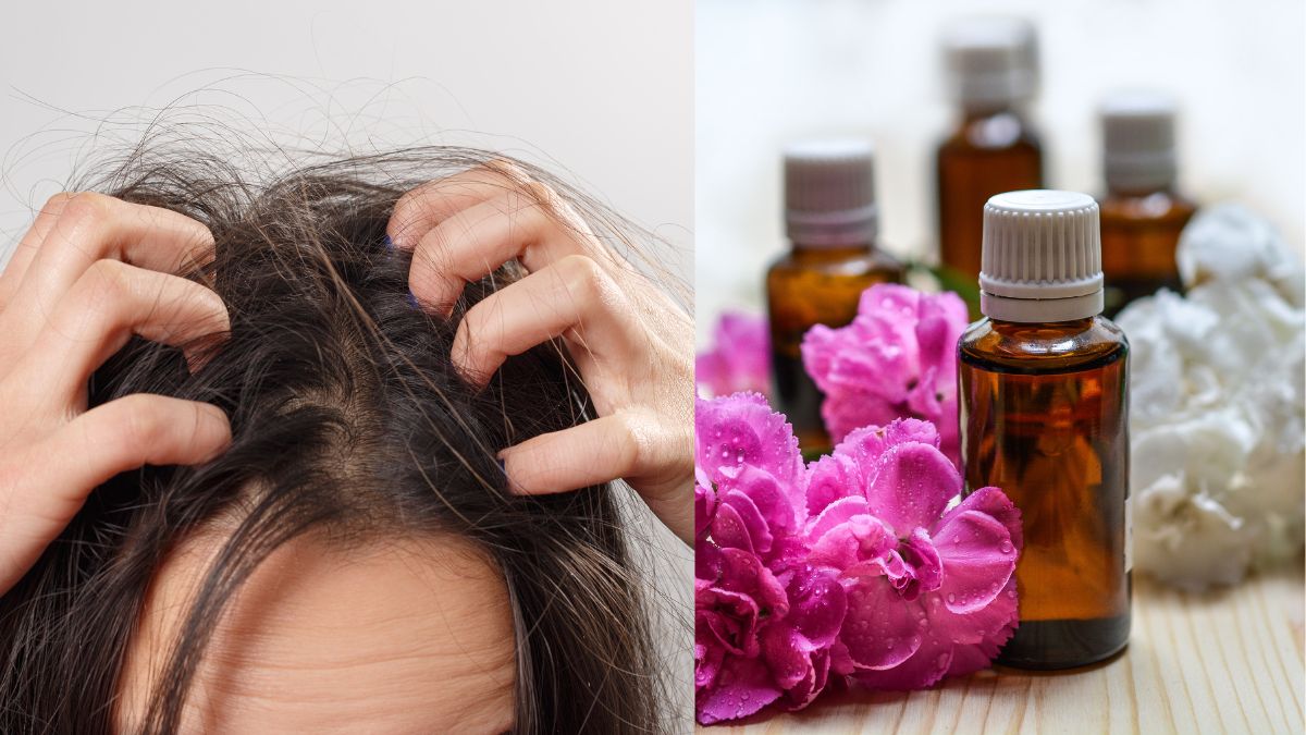 Should Itchy Scalp Treatments Include Natural Oils